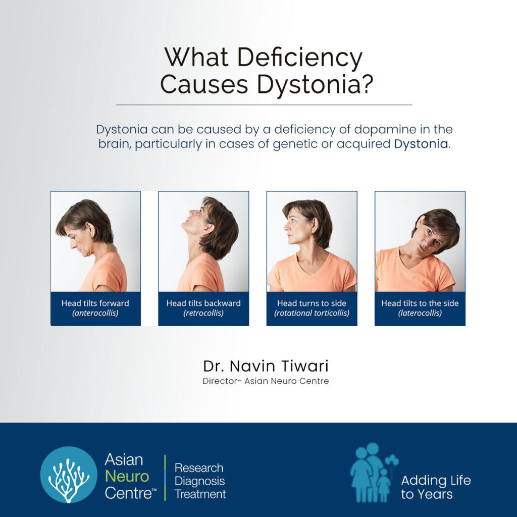 What Deficiency Causes Dystonia?