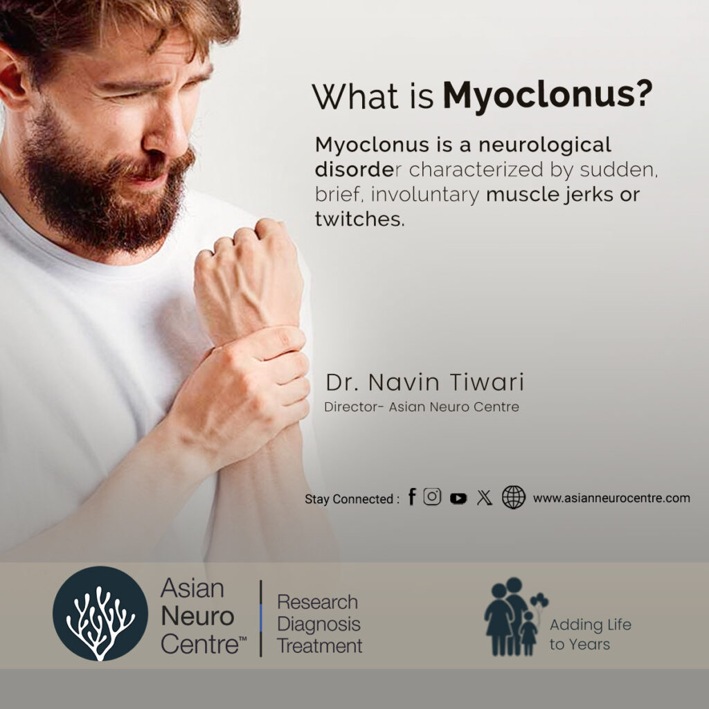 What is Myoclonus?, Symptoms, Causes, Treatment & More