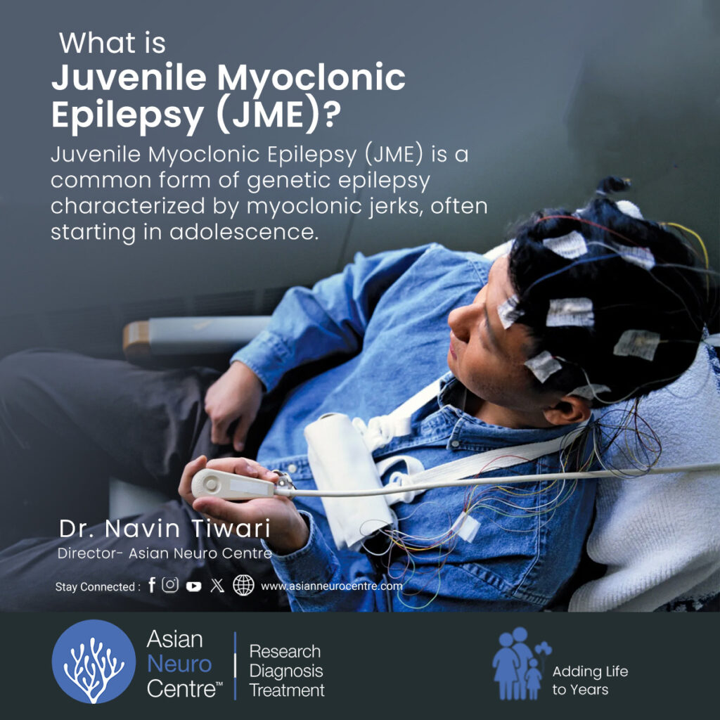Juvenile Myoclonic Epilepsy, Symptoms, Causes, Treatment 