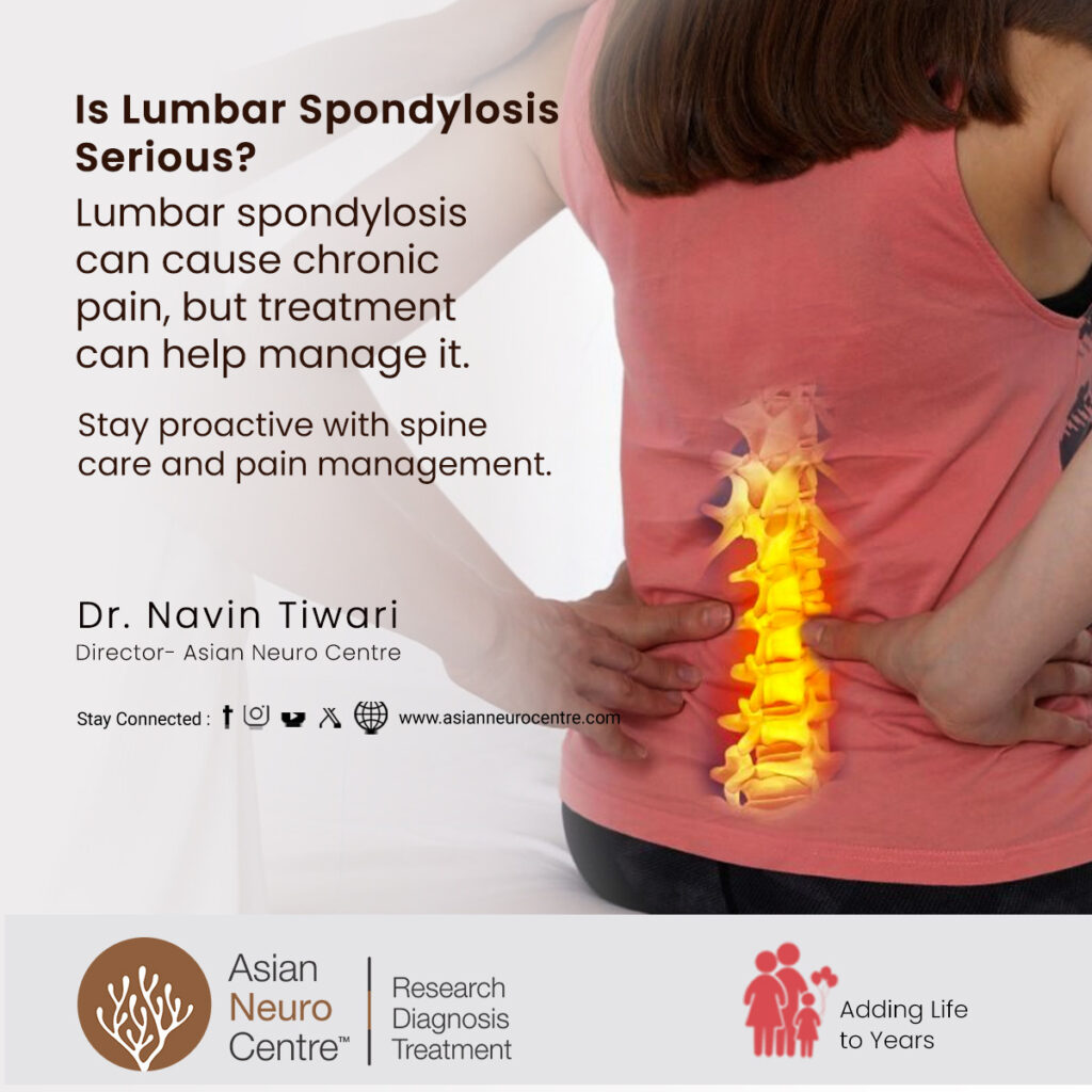 Is Lumbar Spondylosis Serious? 
